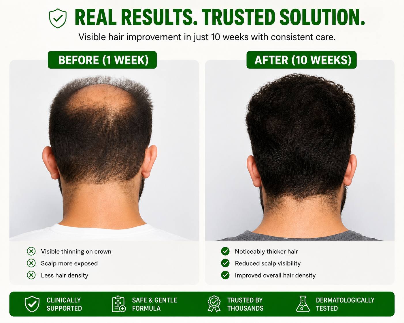 HAIR REGROWTH SYSTEM