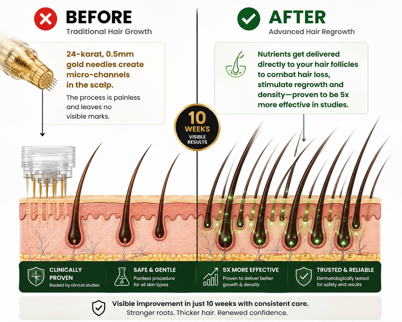 HAIR REGROWTH SYSTEM