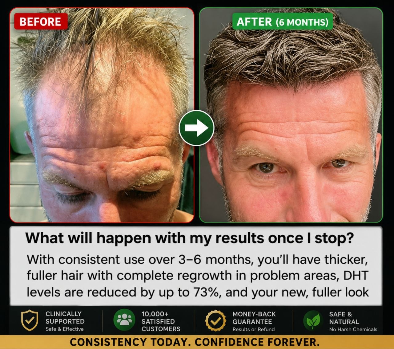 HAIR REGROWTH SYSTEM