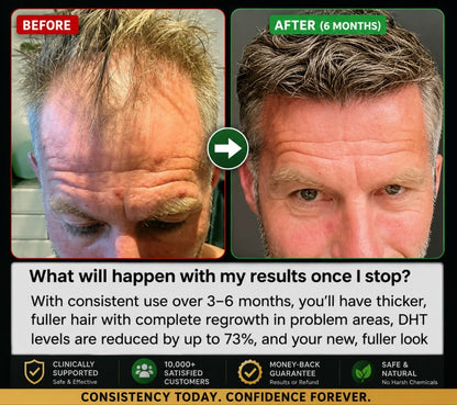 HAIR REGROWTH SYSTEM